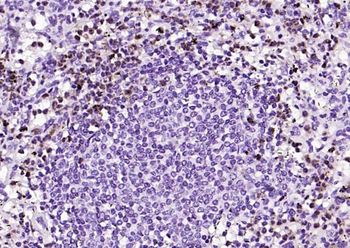 Lactoferrin Mouse Monoclonal Antibody