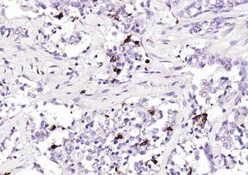 S100-A8/A9 Rabbit Polyclonal Antibody