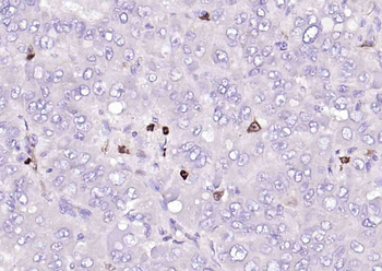S100-A8/A9 Rabbit Polyclonal Antibody