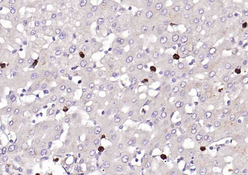 S100-A8/A9 Rabbit Polyclonal Antibody