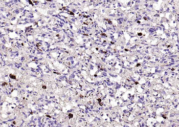 S100-A8/A9 Rabbit Polyclonal Antibody