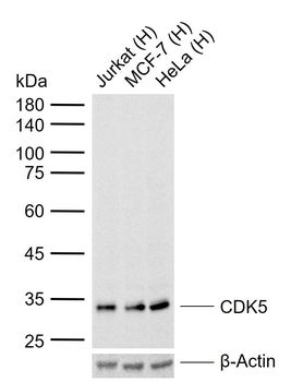 CDK5 Mouse Monoclonal Antibody
