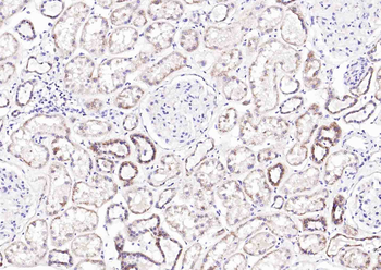 Raptor Rabbit Polyclonal Antibody