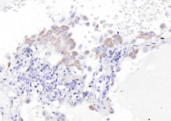 Raptor Rabbit Polyclonal Antibody