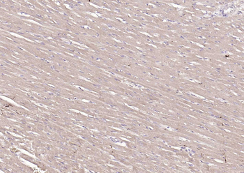 S100A1 Rabbit Polyclonal Antibody