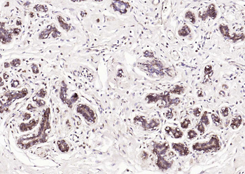 S100A1 Rabbit Polyclonal Antibody