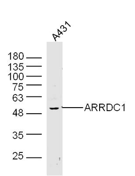 ARRDC1 Rabbit Polyclonal Antibody