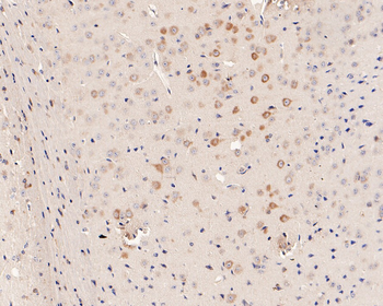 Phospho-EIF2S1 (Ser51) Recombinant Rabbit Monoclonal Antibody