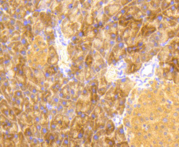 Phospho-EIF2S1 (Ser51) Recombinant Rabbit Monoclonal Antibody