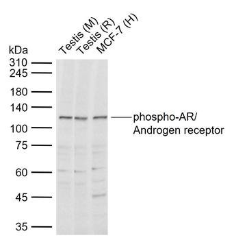 Phospho-AR/Androgen receptor (Ser791) Rabbit Polyclonal Antibody