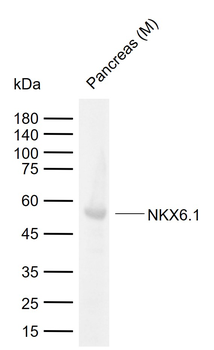 NKX6.1 Rabbit Polyclonal Antibody