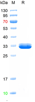 Recombinant human RIPK1 protein, N-His