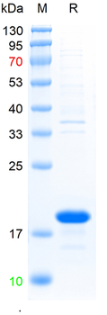 Recombinant human Calreticulin protein, N-His