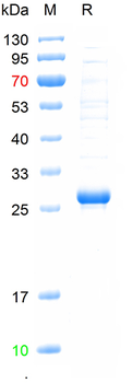 Recombinant mouse ACOX1 protein, C-His