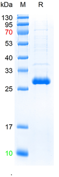 Recombinant human DSN1 protein, N-His