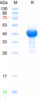 Recombinant mouse NOS2/iNOS protein, N-His