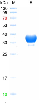 Recombinant human eNOS protein, N-His