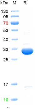 Recombinant human SIX4 protein, N-His