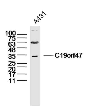 C19orf47 Rabbit Polyclonal Antibody