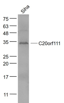 C20orf111 Rabbit Polyclonal Antibody