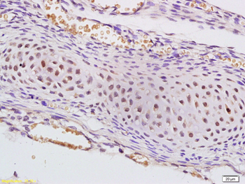 SAP62 Rabbit Polyclonal Antibody