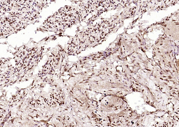 INTS3 Rabbit Polyclonal Antibody