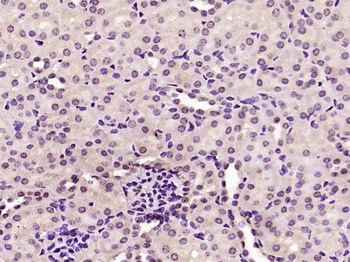 TSEN15/C1orf19 Rabbit Polyclonal Antibody