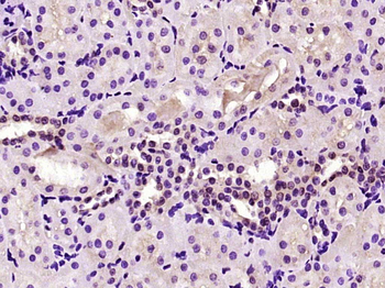 TSEN15/C1orf19 Rabbit Polyclonal Antibody