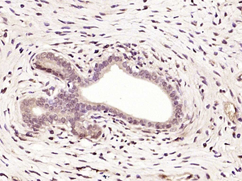 TSEN15/C1orf19 Rabbit Polyclonal Antibody