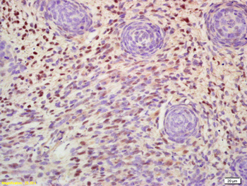 MSX1 Rabbit Polyclonal Antibody