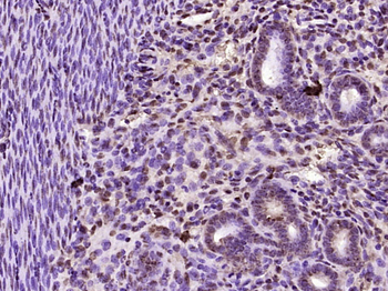 RNF113A Rabbit Polyclonal Antibody