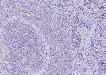 RNF113A Rabbit Polyclonal Antibody