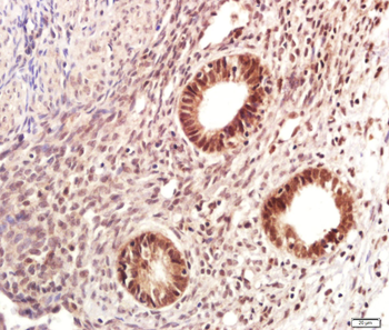 RNF169 Rabbit Polyclonal Antibody