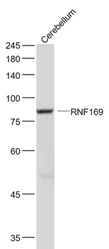 RNF169 Rabbit Polyclonal Antibody