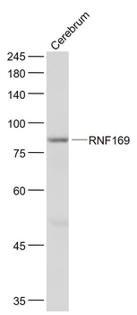 RNF169 Rabbit Polyclonal Antibody