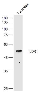 ILDR1 Rabbit Polyclonal Antibody