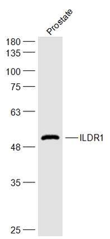 ILDR1 Rabbit Polyclonal Antibody