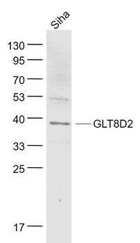 GLT8D2 Rabbit Polyclonal Antibody