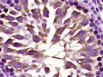 Fbx15 Rabbit Polyclonal Antibody