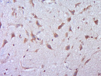 BTBD10 Rabbit Polyclonal Antibody