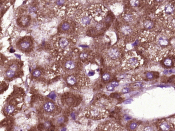 BTBD17 Rabbit Polyclonal Antibody