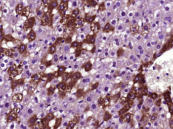 BTBD17 Rabbit Polyclonal Antibody