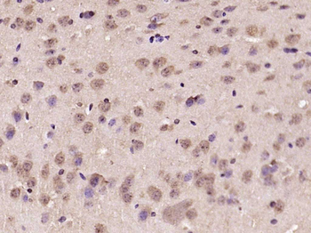 BTBD19 Rabbit Polyclonal Antibody