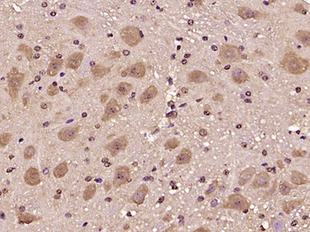 BTBD19 Rabbit Polyclonal Antibody