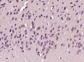 BTBD19 Rabbit Polyclonal Antibody