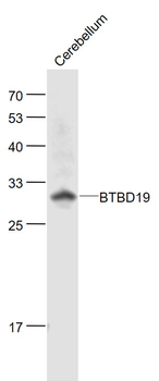 BTBD19 Rabbit Polyclonal Antibody