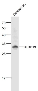 BTBD19 antibody