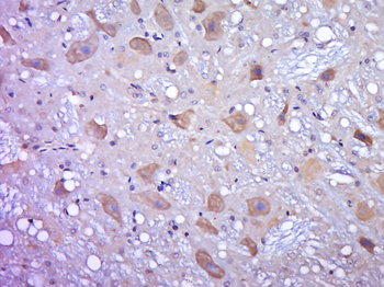 OGFOD2 Rabbit Polyclonal Antibody
