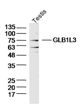 GLB1L3 Rabbit Polyclonal Antibody