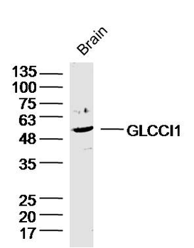 GLCCI1 Rabbit Polyclonal Antibody